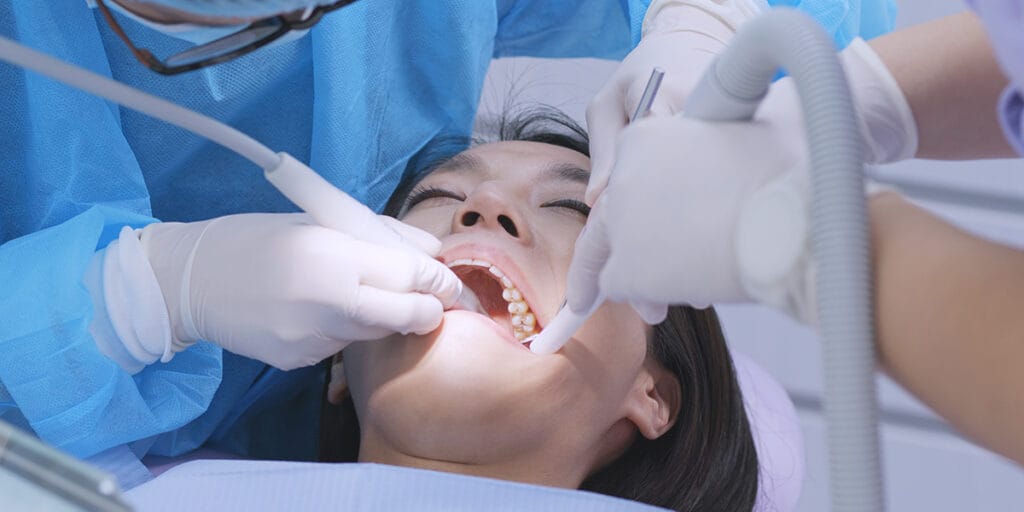 Tooth Removal Under Sedation l Sedation for Teeth Extractions