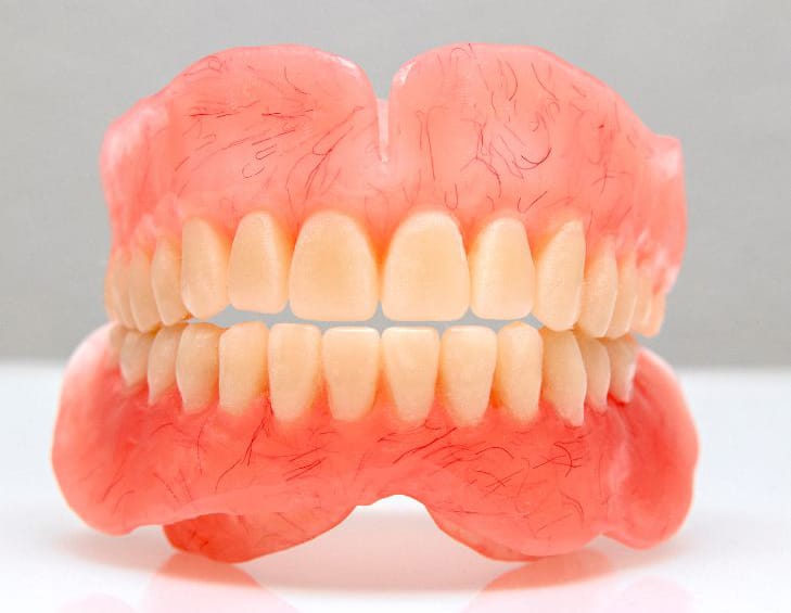 Full-Conventional-Dentures
